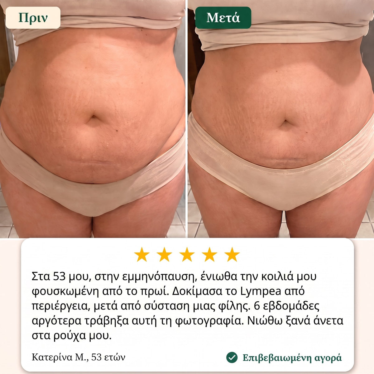 Lympea πριν και μετά